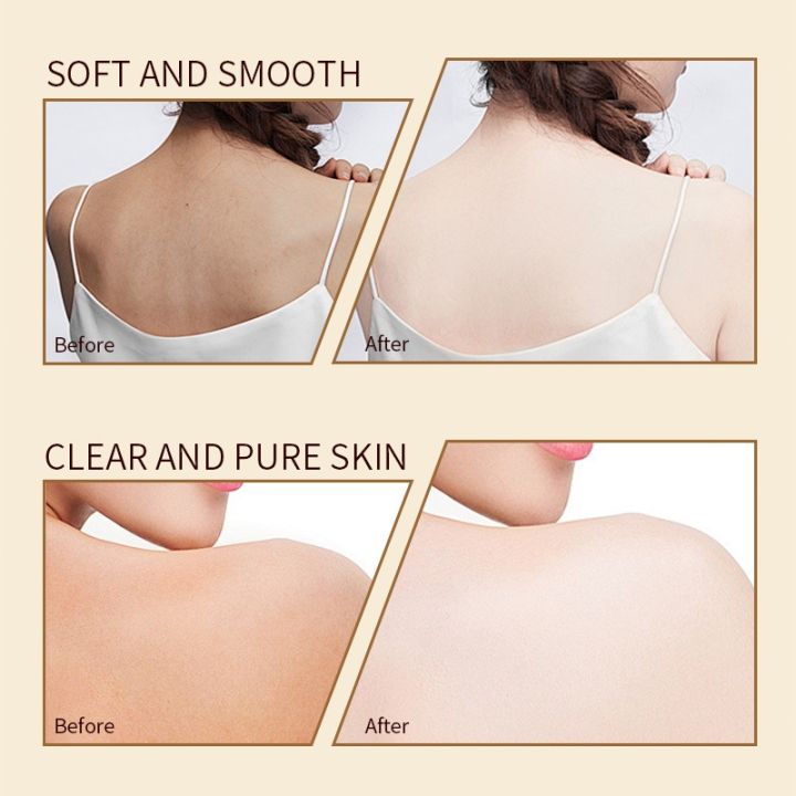 Body%20Wash%20Psoriasis%20Eczema%20Anti%20acne%20Mite%20Remove%20Moisturizing%20SulfurMite%20Removal%20Shower%20Gel%20-%20Image%207