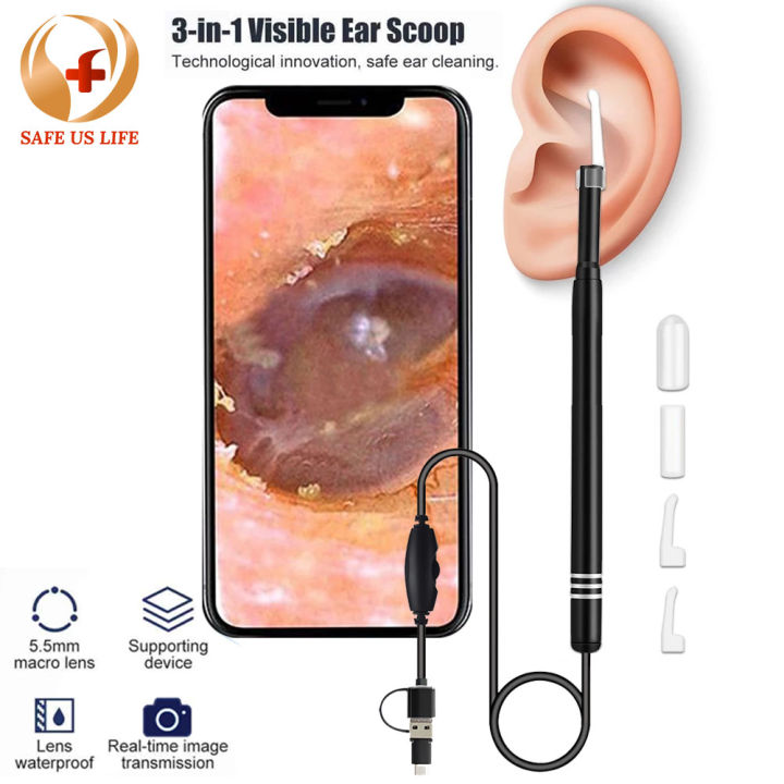 Smart Visual Ear Cleaner Ear Stick Endoscope Earpick Camera Otoscope ...