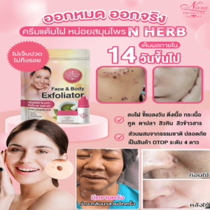 [ไม่มีจุดด่างดำ ไฝ หูด แม้แต่น้อย! ] กล่องดูแลผิวกำจัดไฝและฝ้า  ชุดดูแลผิว ชุดกำจัดไฝ ชุดกำจัดจุดด่างดำสำหรับฝ้า