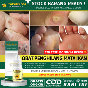 OBAT MATA IKAN DI TELAPAK KAKI - OBAT TETES PENGHILANG MATA IKAN DI TELAPAK KAKI / TANGAN - PERONTOK MATA IKAN / CLAVUS - OBAT OLES UNTUK MATA IKAN / KAPALAN / KUTIL / SKINTAG / KAKI RAYAPAN - OBAT TETES / OLES PROPOLIS SM (Bukan Plester / Callusol)