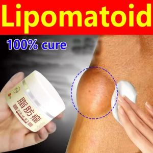 Krim Penghilang Lipoma Gel Gel Kelkelenjar Benjoran Lipoma Lipoma Pelembap Nyeri Menghilangkan Salep Multi-efek Anti-tumor Gel Khusus untuk Menghilangkan Beberapa Lipoma Disinfeksi Lipoma Tunggal Bulge 30g