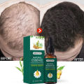 Penumbuh rambut cepat dan tebal Menyehatkan Kulit Kepala&Meningkatkan Regenerasi Rambut - Penumbuh rambut botak ampuh - Obat penumbuh rambut super cepat - Penumbuh rambut botak paling cepat - obat penumbuh rambut botak - Rambut rontok perawatan. 