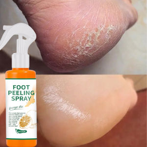 Ready stock Foot Peeling Spray Tumit Kaki Merekah Pedicure Hands Dead Skin foot Exfoliator spray Whiten Foot Care