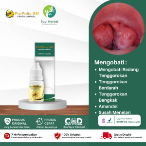 Obat Amandel Obat Sakit Radang Tenggorokan Radang Amandel Amandel Anak Amandel Bernanah Amandel Dewasa Amandel Bengkak Obat Herbal Propolis SM