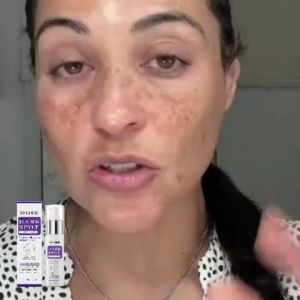 Eelhoe Niacinamide Melasma Brightening Cream Reduce Melanin Brighten Cream Lighten Dark Skin Chloasma Serum Fade Fine Face Lines 50g
