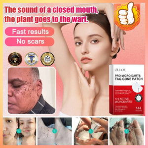 💕Fast Shipping💕Corn Patch Plant Wart Removal Callus Removal Plantar Thorns Flat Meat Grains A Worry-free Wart Removal Artifact 速效净疣贴 Tampalan Penyingkiran Ketuat Bertindak Pantas