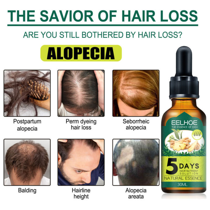 Anti Alopecia Fast Hair Growth Oil Ginger Essential Serum Hairless Anti Alopecia Fast Hair Growth Oil Ginger Essential Serum Hairless