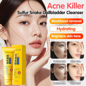 【Oil Acne Killer】【Oil Acne Killer】💕Sulfur Snake Gallbladder Oil Control Cleanser Hydrating and Moisturizing Deep Cleansing Pores Without Tightening Facial Cleanser Facial Milk for Women