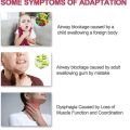 HAYLE Anti Suffocation Choking Emergency Device Easy To Use Breathing Trainers Asphyxia CPR LifeVac Portable Anti Choking Rescue Device Asphyxia Rescue. 