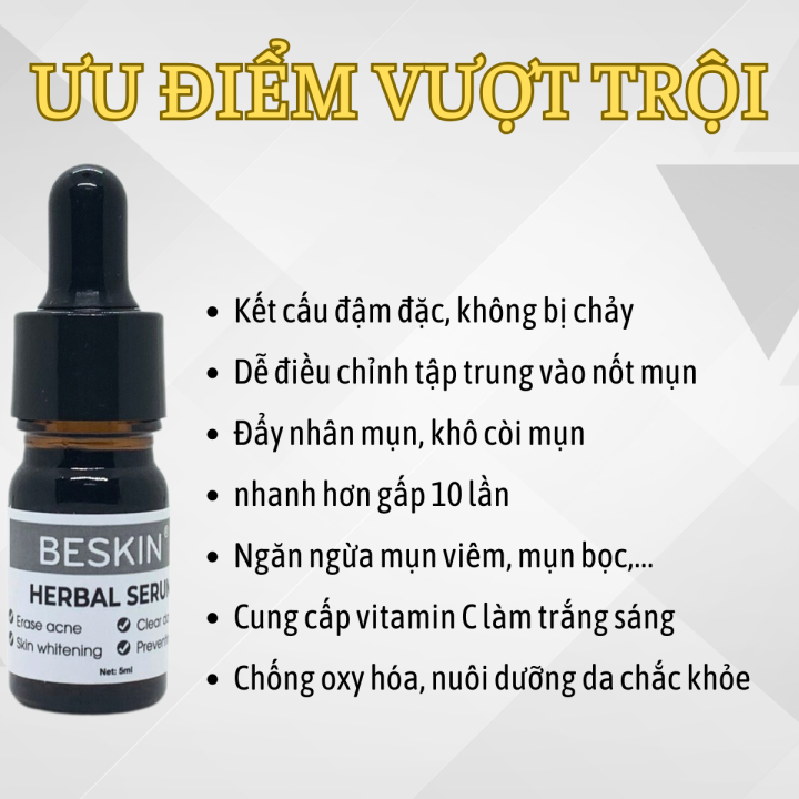Serum%20M%E1%BB%A5n%20Beskin%20Herbal%20Serum,S%E1%BA%A1ch%20M%E1%BB%A5n,M%E1%BB%9D%20Th%C3%A2m%20Gi%C3%BAp%20L%C3%A0m%20%C4%90%E1%BB%81u%20M%C3%A0u%20Da%205%20ml%20-%20Image%205