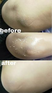 [FDA]Herbal Extract Exfoliating Gel: Facial & Body Scrub for Blackhead Removal & Deep Cleansing