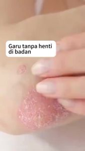 bai yao lang cream ointment Best Skincare Strong Fungus Killer Rash Cure Ointments to Control Lesion Rednesses Burn Allergic Reaction Lunas Sa Kati Eczema Best Relief Ready Stock Buy It Fantastic Good