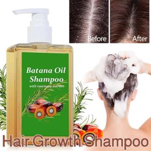 Anti-hair Loss Shampoo Hair Growth Shampoo Anti-itching Oil Control Repair Treatment Regrowth Hair Thick