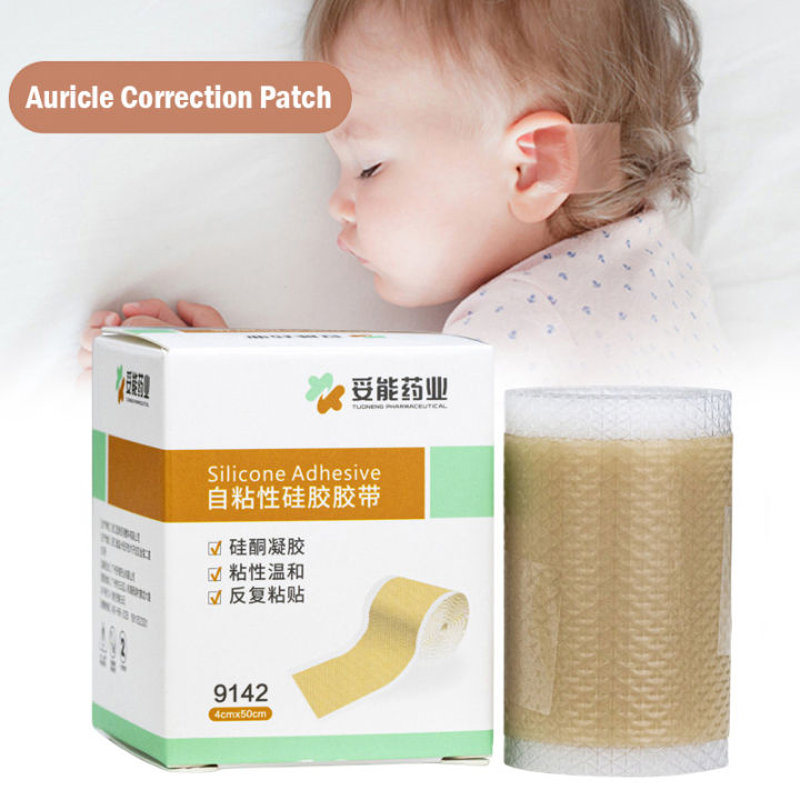 Baby Ear Corrector Infant Protruding Ears Correction x 50cm