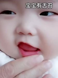 Safe Optimal SelectionDr.Isla 3in1 Baby silicone toothbrush infant Tongue Cleaner Baby Oral Care 0-2year BY11