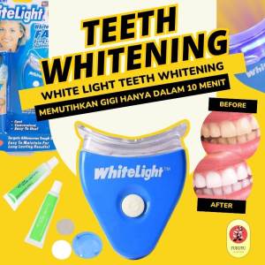 Alat Pemutih Pencerah Gigi Elektrik Teeth White Light Whitening Lampu LED Akselerator Sinar UV Penghilang Perontok Pembersih Membersihkan Memutihkan Menghilangkan Noda Karang Plak Gigi Kuning Instan Instant Super Cepat Natural Alami Permanen