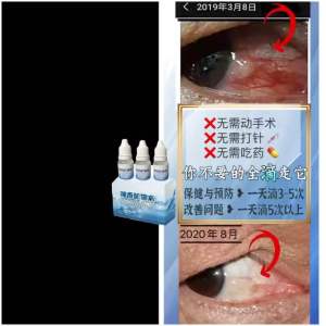 Magical 10ml 3 1 eyecare/Cell rebirth/eyedrop/Pelindung Mata