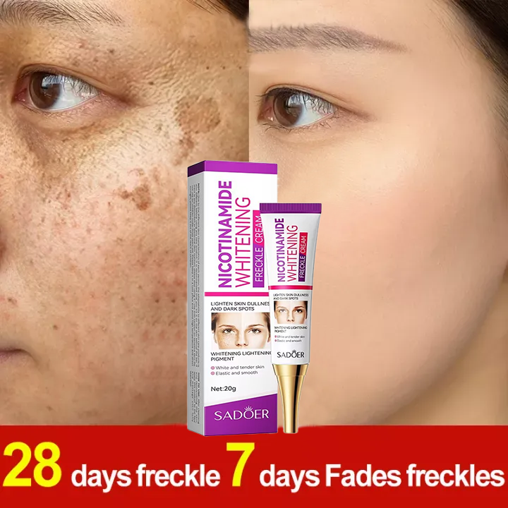 7 Days Whitening Cream Strong Age Black Spot Melasma Wrinkles Skin