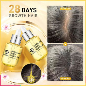 เซรั่มน้ำมันหอมระเหยน้ำยารักษาหนังศรีษะซ่อมแซมเส้นผมที่สึกหรอหนาแน่นสำหรับผู้ชายผู้หญิง30มล. สารสกัดจากผมร่วงป้องกันผมร่วงและผมร่วง