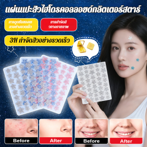 【ระบายอากาศและดูดซับหนอง】แผ่นแปะสิวคอลลอยด์น้ำรูปดาวกลิตเตอร์นุ่มๆ ช่วยขจัดสิวที่มองไม่เห็นที่เกาะติดหัวใจของสาวๆ