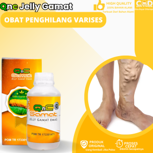 Obat Penghilang Urat Varises Obat Varises Di Kaki Penghilang Varises Bengkak Obat Varises Di Betis Kaki Obat Varises Tangan Obat Urat Menonjol Obat Varises Esofagus Dengan Qnc Jelly Gamat
