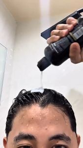 KORMES Minoxidil 5% Hair Grower with Biotin Shampoo And Conditioner 300ml for Hair Loss Treatment