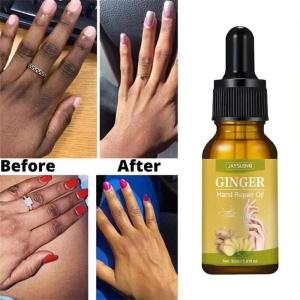 new Dark Knuckles Fast Whitening Serum Brightening Pigmentation Correctors For Black Skin Intense Stains Remover Essence Products hot