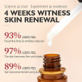 Retinol Serum For Face Face Retinol Serum Original Retinol Serum Brightening Retinol Serum For Melasma. 