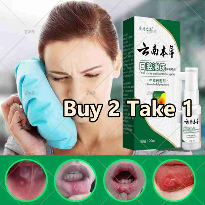 【Buy 2 Take 1，Buy 4 Take 2】canker mouth sore solution mouth ulcer ...