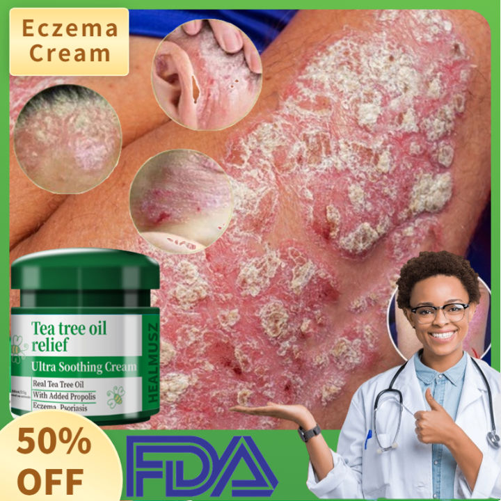 Eczema cream Antibacterial Cream Diaper Rash Cream For Baby Fungi Itchy