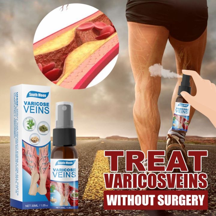 ORIGINAL VARICOSE VEINS OIL Lazada PH