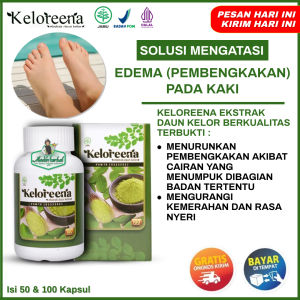 Obat Edema Kaki Bengkak Penumpukan Cairan Obat Kaki Bengkak Kaki Bengkak Diabetes Asam Urat Keloreena Original Untuk Mengatasi Edema / Pembengkakan