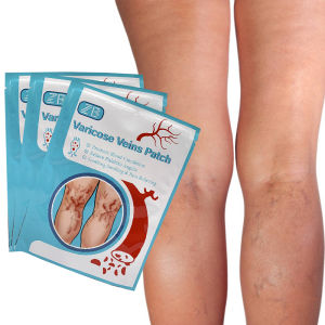 Varicose Veins Remover Effective For Legs Varicose Veins Patches Phlebitis Spider Anti-swelling Angiitis Removal Chinese Medical Plasters（6pcs/bag）