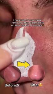 LANBENA Blackhead Remover Nose Strip Deep Cleansing Blackheads Removal White Blackhead Exfoliating Facial Peeling Oil Control Shrinking Pores Face 2% HBA White Clay Skin Care 30g