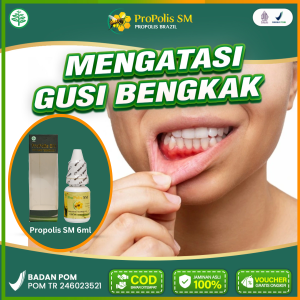 Obat Gusi Bengkak dan Nyeri Gigi Goyang Berdarah Radang Bernanah Sakit Ketika Mengunyah Propolis