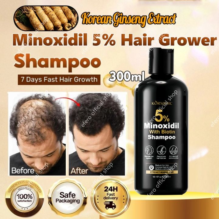 Minoxidil 5 Hair Grower with Biotin Shampoo And Conditioner 300ml for