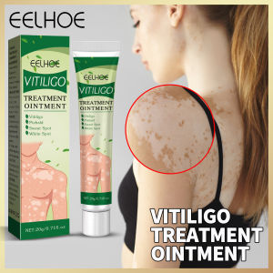 Eelhoe whitespot Kem phục hồi da để làm sáng đốm mồ hôi tại chỗ bàn tay và da chân rêu Sửa chữa da whitespot làm sạch Thuốc mỡ bạch biến điều trị thuốc mỡ đốm trắng Kem phục hồi da phai piebald mồ hôi điểm leukoplakia bệnh giun đũa da cơ thể C