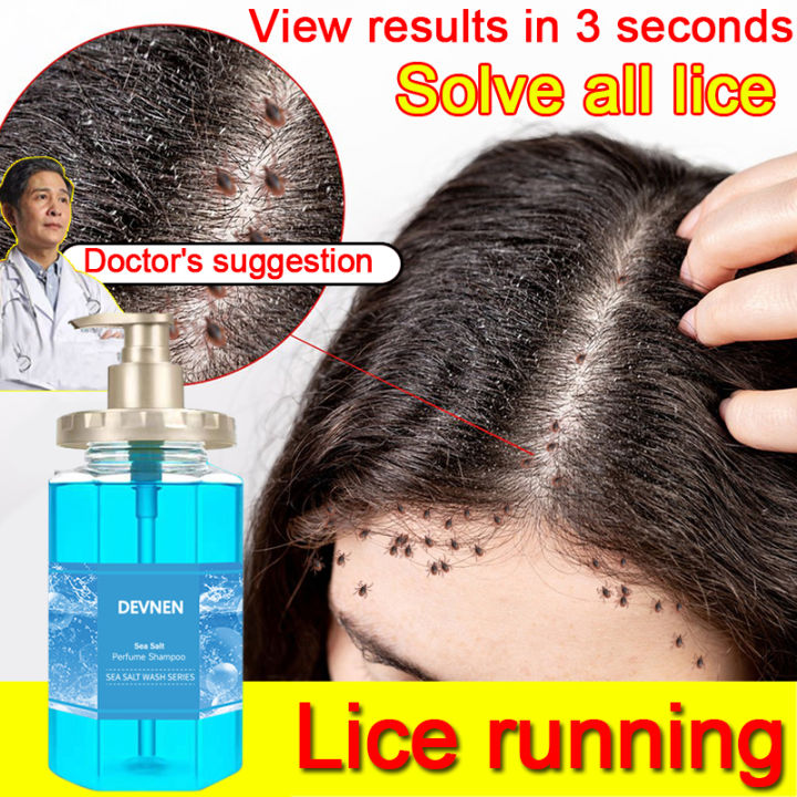 Fungal shampoo Antifungal hair shampoo Dandruff treatment shampoo