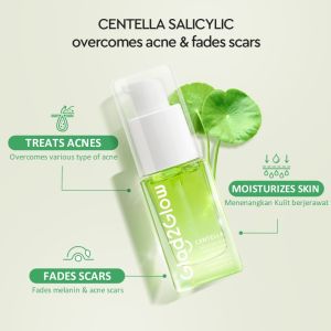 Glad2Glow Centella 2% Salicylic Acid Power Clear Acne Serum 17ml | Clears Acne Reduces Redness & Prevents Breakouts for Oily Skin