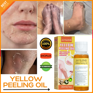 LEGIT! Yellow Peeling Oil Whitening Bleaching Moisturizing Yellow Peeling Oil For Whole Body Effect Remove Dark Skin Brightening Whiten Body Treatment Peeling Oil Lighten Elbows Knees Hands Skin Body Peeling Oil