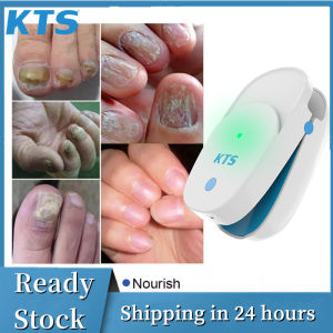 [Ready Stock]KTS  NEW Fungus Treatment Laser Device Revolutionary Home Use Nail-fungus Remover