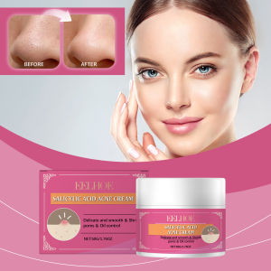 EELHOE Acne Cream gentle smooth refreshing and comfortable facial soothing and moisturizing cream Pimple Cream Acne Cream For Face