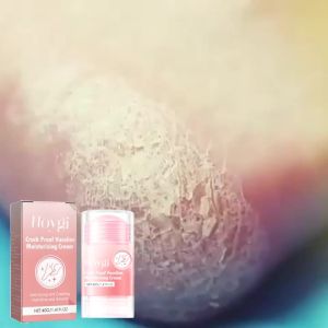 💪 Strong & DurableHoygi Anti-Chap Hand and Foot Moisturizing Stick Foot Care Anti-Dryness Exfoliating Dead Skin Hand and Foot Moisturizing Stick
