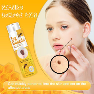 Wart Remover buang tahi lalat Ubat kutil Ketuat remover Skin tag