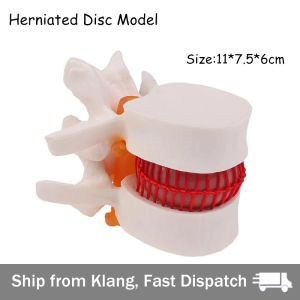 【READY STOCK】35x Magnified Skin Model/Human Tissue Structure Anatomical/Skin Structure Anatomy Model/Medical Education