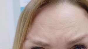 Miếng Tẩy Tế Bào Chết AHA 35% Glycolic Acid Làm Mịn Da Mặt Tẩy Tế Bào Chết Bằng Axit Salicylic Khăn Tẩy Tế Bào Chết Hóa Học Miếng Tẩy Tế Bào Chết Glycolic Giảm Nếp Nhăn Mụn Thâm Nám 50 Miếng