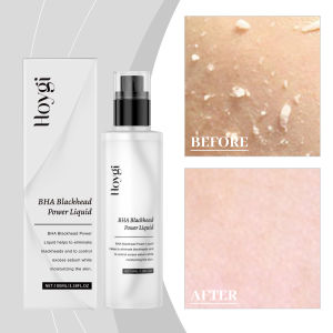 Hoygi Blackhead Power Liquid Removal Solution Deep Pore Cleaning Blackhead Export Liquid 100ml