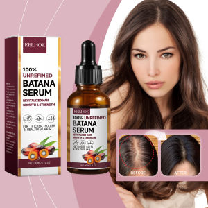EELHOE Batana Serum Batana Oil For Hair Growth Pure Batana Oil For Hair Growth Anti Hair Loss 30ml