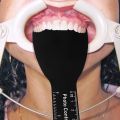 6Pcs Dental Photography Black Background Board Dental Photo Contrast Dental Fotografi Hitam. 