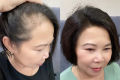 Kẽm biotin mọc tóc ngăn rụng tóc. 